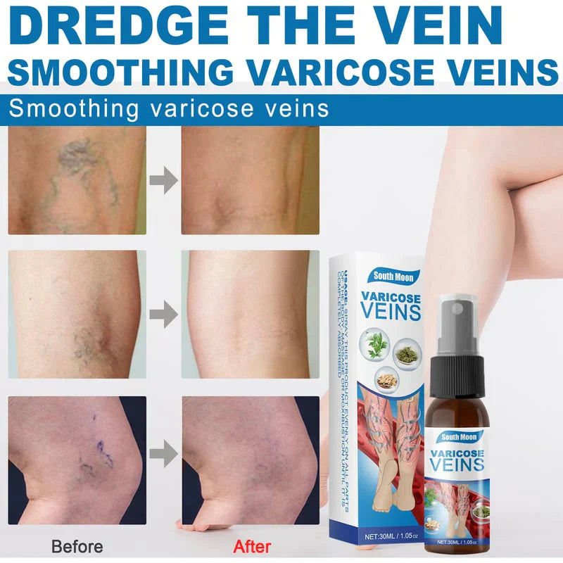 Varicose Veins Spray